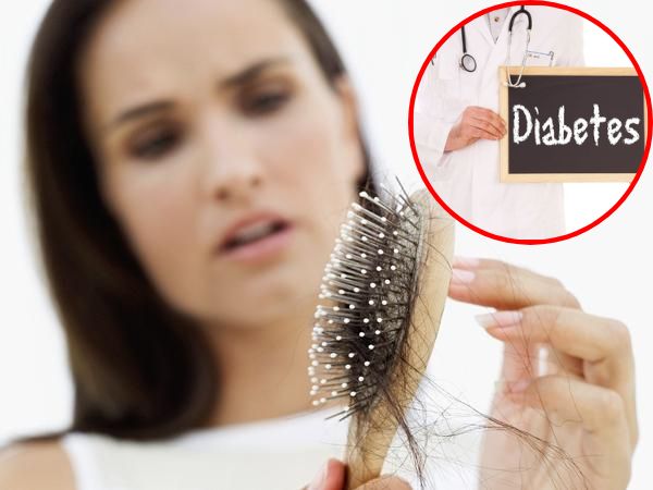 Tips To Prevent Hair Loss In Diabetic Patients In Telugu