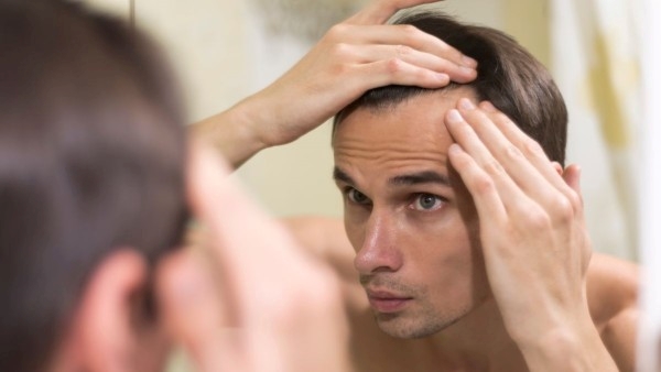Ayurveda Remedies To Get Rid Of Male Baldness In Telugu