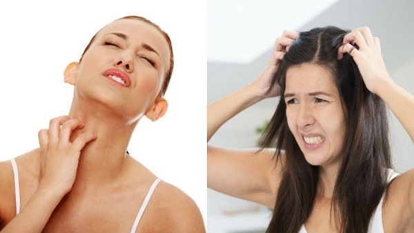 Monsoon skin and hair allergies and remedies to follow