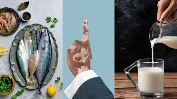 Drinking Milk After Eating Fish Cause Skin Diseases Know In Telugu