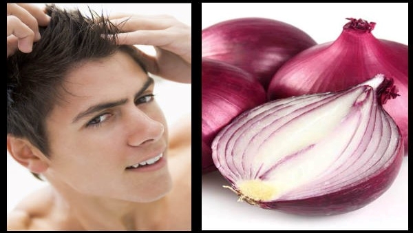 How To Use Onion Juice For Hair Loss, juttu peragadaniki Ullipaya rasam ela vadali