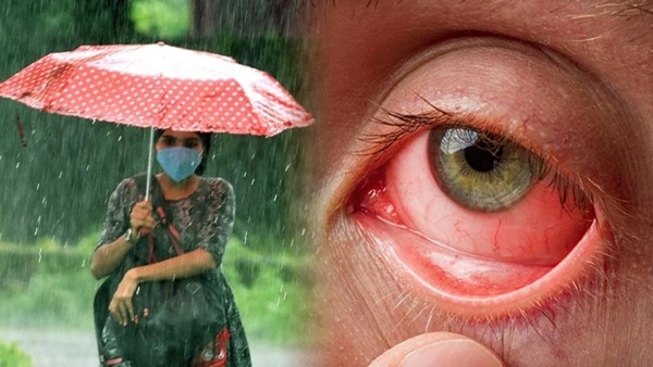  Eye Flu OR Pink Eye: What Are The Myths and Facts About Pink Eye in telugu