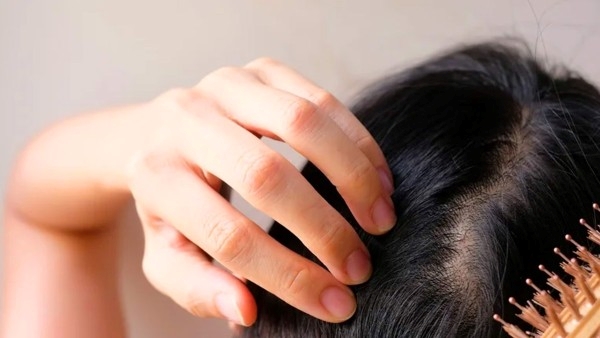 Vitamin B12 deficiency: Dont Ignore These Signs In Hair