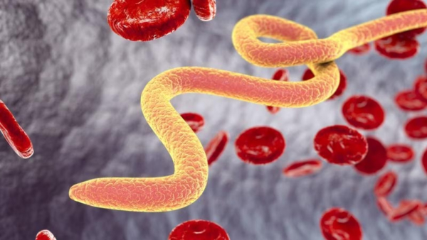 Australia: Live Parasitic found in patients brain: Doctors shocked by scan