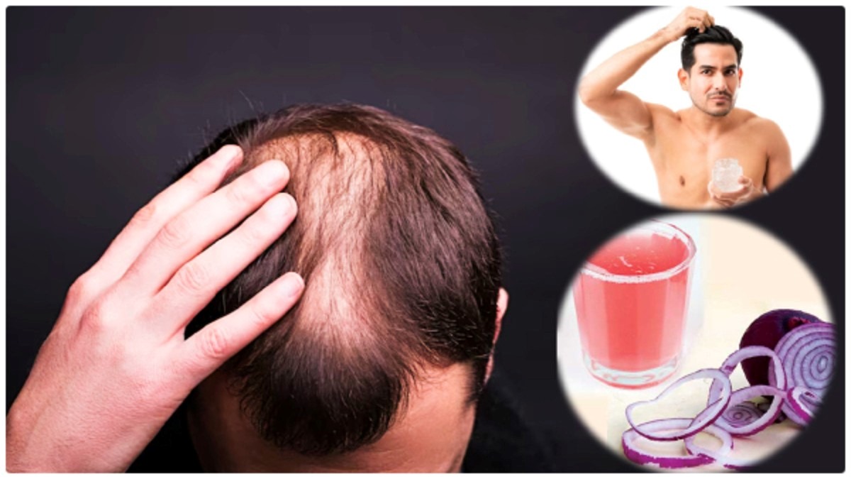 Diy overnight hair masks for men suffering from hair loss in Telugu