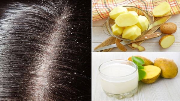 How To Use Potato Juice For Hair Growth in Telugu