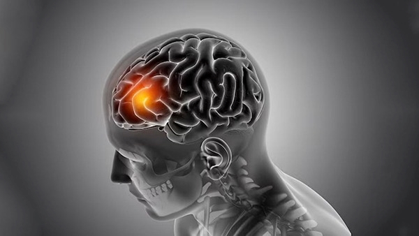 World Stroke Day 2023