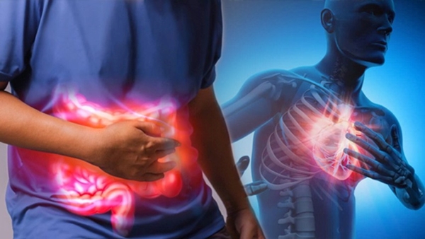 Chest Pain Vs Acidity
