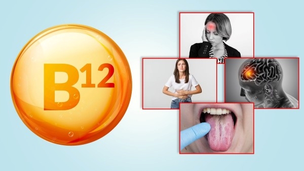 Vitamin B12 Vitamin B12