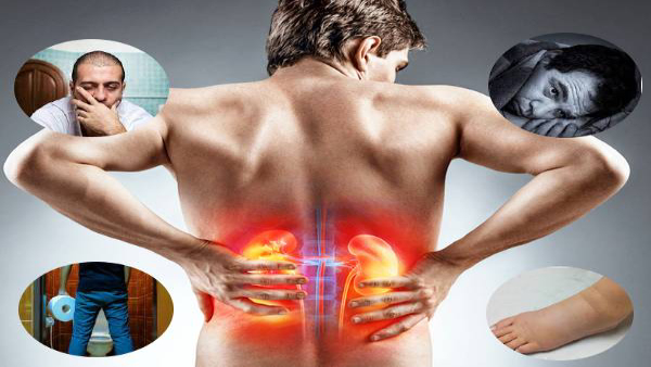 Top 10 Kidney Failure Symptoms in Telugu