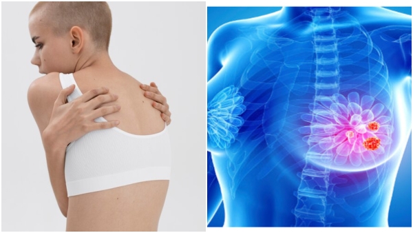 Breast Cancer Is Behind Your Back