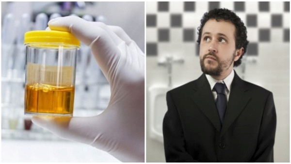 why urine yellow in colour