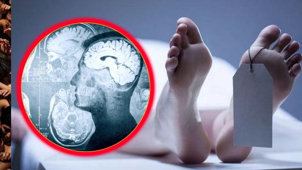 10 Bodily Functions That Continue After Death 10 Bodily Functions That Continue After Death