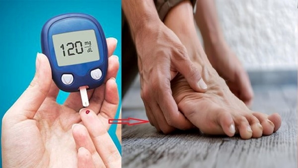 Diabetes: High Blood Sugar Symptom you can See on your Feet in Telugu