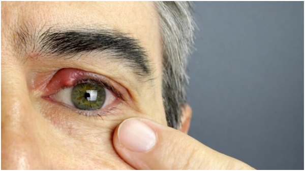 World Cancer Day 2024