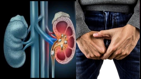 Can Kidney Problems Cause Erectile Dysfunction