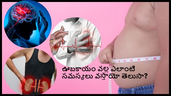 Health Issues related To Obesity