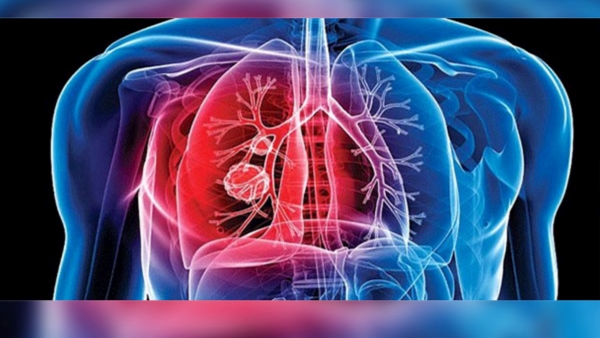 World Tuberculosis TB Day 2024