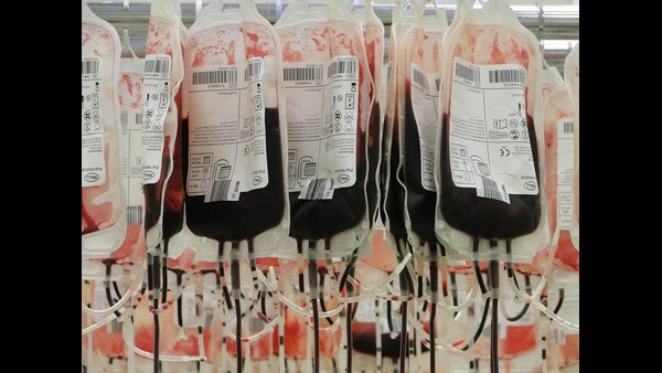 what are the characteristcis and availability of bombay blood group in telugu