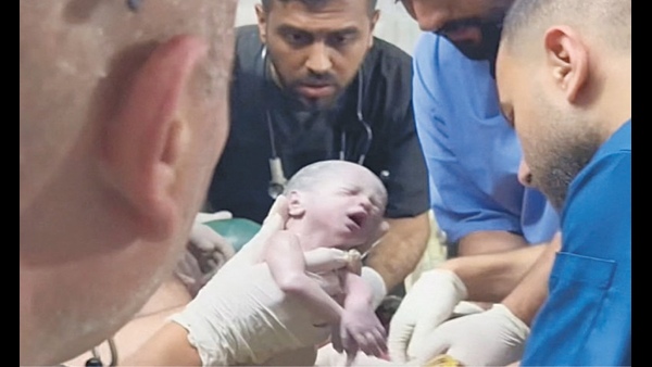 Six children born at a time in rawalpindi pakisthan and how it is possible to give birth to six children at time in telugu