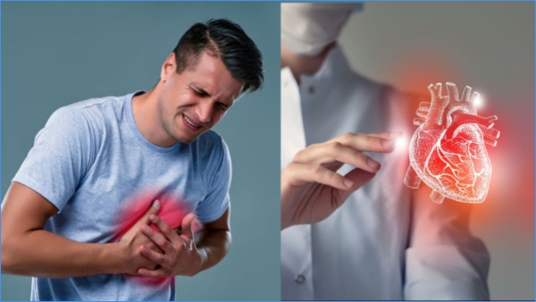 Heart Attack Symptoms