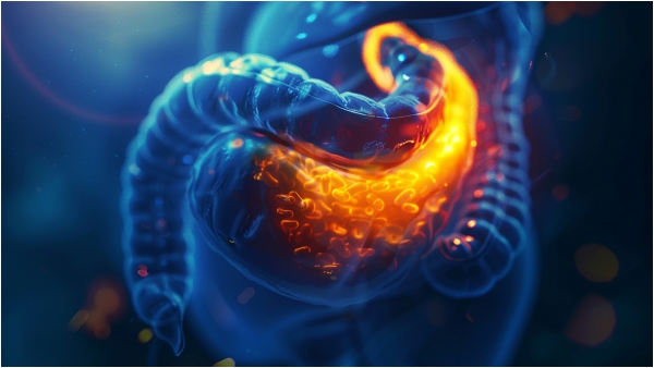 570-gallbladder-stones-removed-from-a-women-stomach