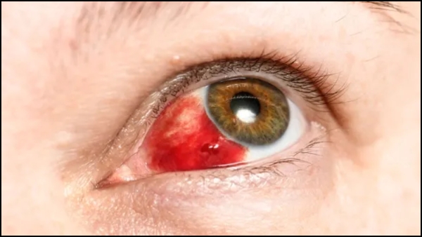 A 74-year-Old Man has died in Spain from an Ebola-like virus A 74-year-Old Man has died in Spain from an Ebola-like virus