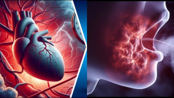 heart attack heart attack