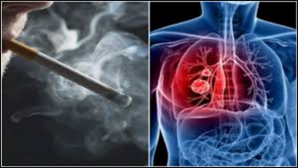 World Lung Cancer Day 2024