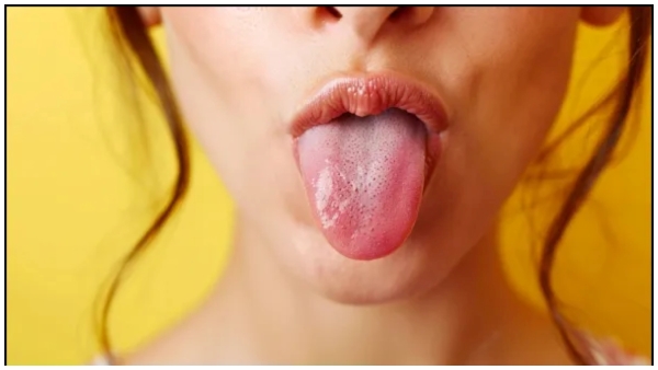 AI model can detect diseases just by looking at the tongue AI model can detect diseases just by looking at the tongue