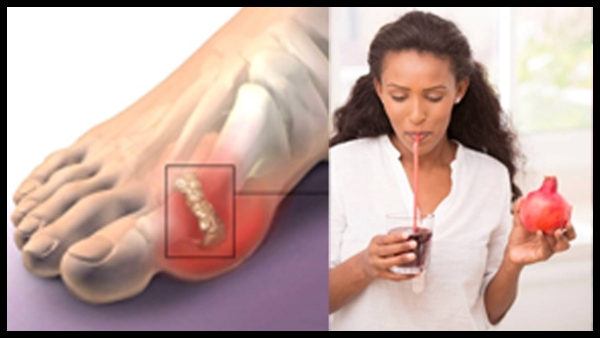 Does pomegranate juice lower uric acid