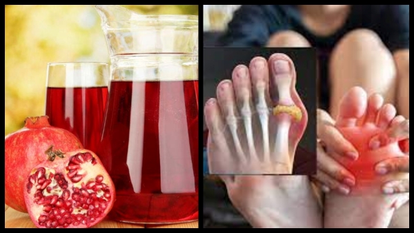 Does pomegranate juice lower uric acid