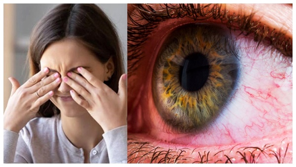 What happens if you rub your eyes too much