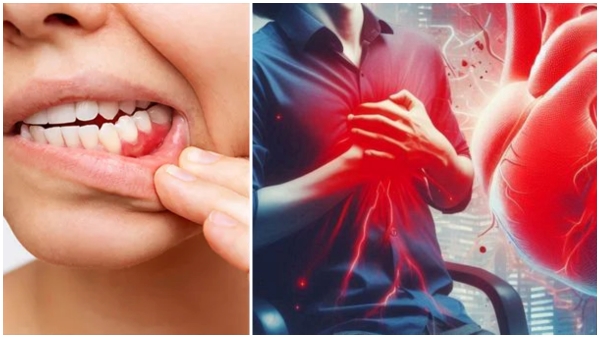 link between gum disease and heart health