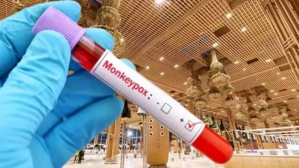 Monkeypox Alert Monkeypox Alert