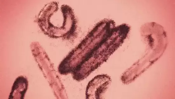 Dangerous bleeding eye virus symptoms and treatment Here is everything you should know about it