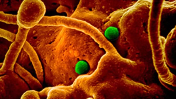 Possibilities of New virus in china in india