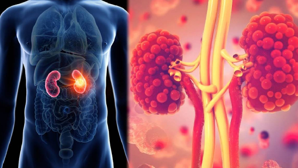 If these symptoms appear at night in your body your kidneys are in danger