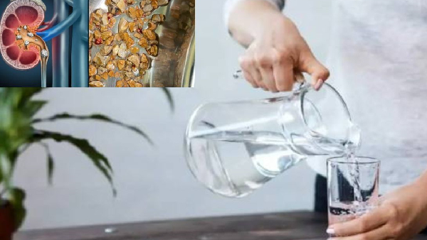 will drinking water help kidney stones go away and how much water to drink to dissolve kidney stones will drinking water help kidney stones go away and how much water to drink to dissolve kidney stones