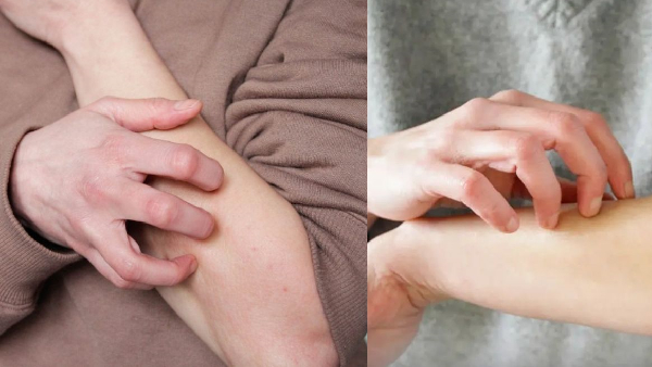 Do you know scratching might be good for you scientists revels shocking facts