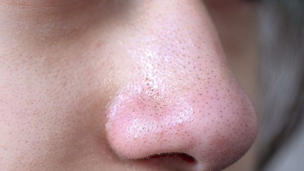 Do you have black spots on your nose Apply these for instant removal