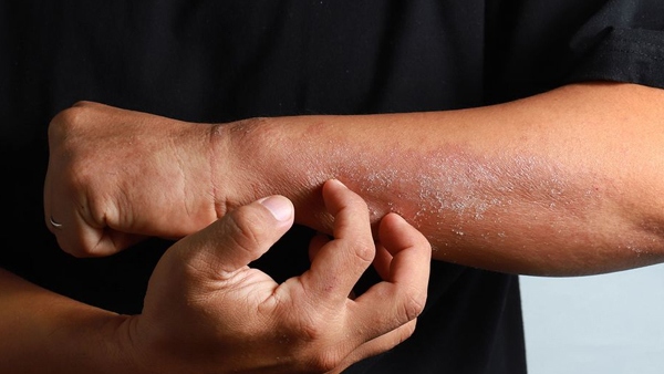What skin diseases will come if we go under heavy temperature