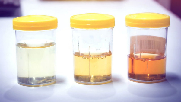 How much water should you drink this summer your urine color will tell you How much water should you drink this summer your urine color will tell you