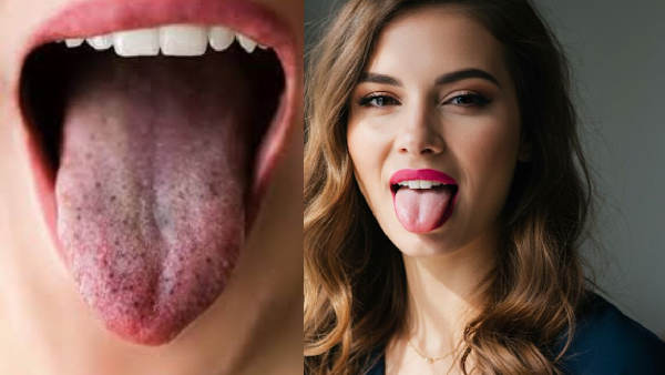 Spotting These Changes on Your Tongue It Could Be Cancer Sign