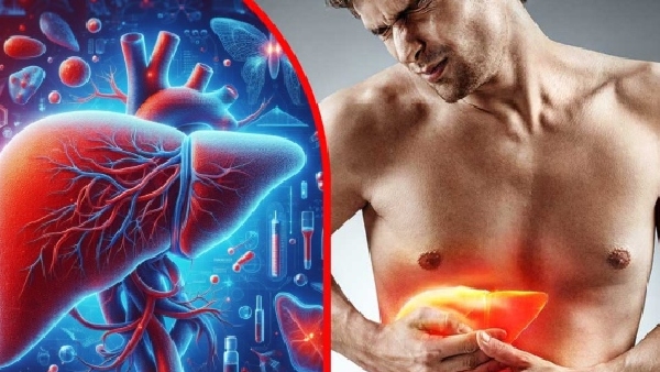 Global Alarm Experts Warn of Looming Liver Disease Crisis