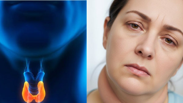 Thyroid Health A Simple Guide to Symptoms and Solutions Thyroid Health A Simple Guide to Symptoms and Solutions