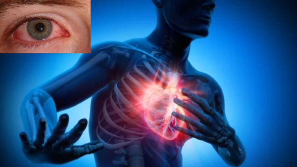 Beyond Vision Your Eyes Can Reveal Your Heart s Secrets