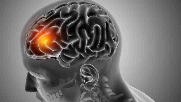 Don t Ignore These 7 Symptoms They Could Be Early Warnings of a Brain Tumor
