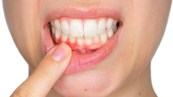 Can t Bear a Toothache Try These Simple Home Remedies for Quick Relief