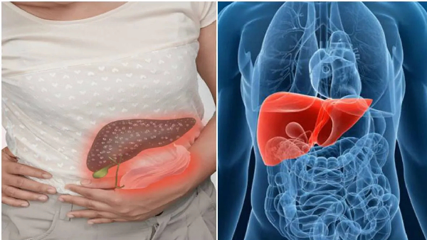 Your Chair Your Liver s Silent Killer The Alarming Link Between Sitting and Fatty Liver